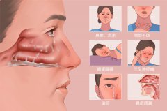 引起慢性鼻炎的原因有哪些？成都耳鼻喉醫(yī)院分析