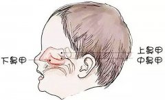 成都看鼻科口碑醫院_如何自查自己是否患有鼻甲肥大？